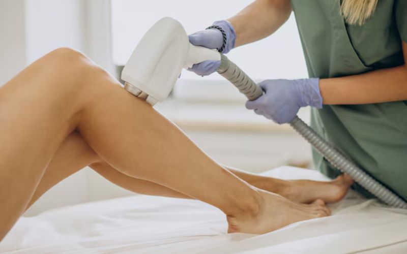 Laser Hair Removal