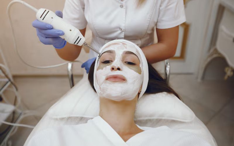 chemical peel