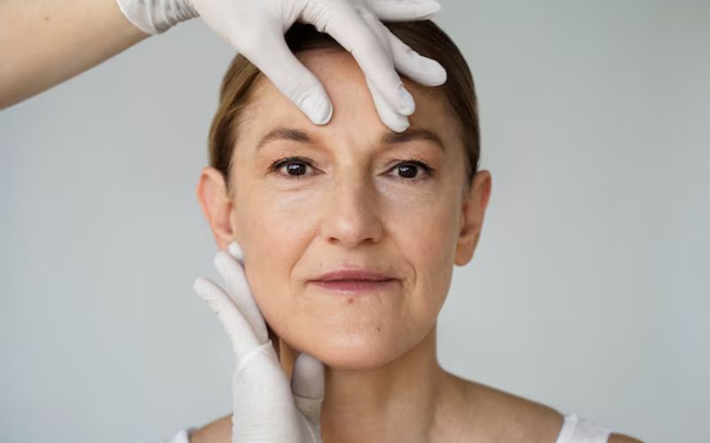 botox for wrinkles