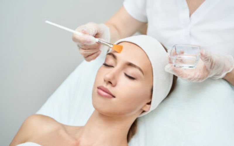 facial peel